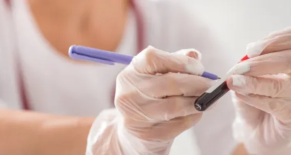 HIV Test (Confidential)
