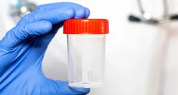 Discreet STD 20 Test - (48 hours)
